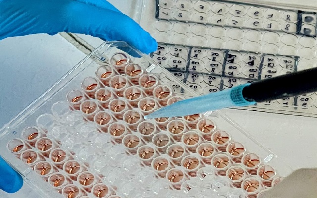 DESCUBRIMIENTO MUNDIAL CONTRA EL CÁNCER